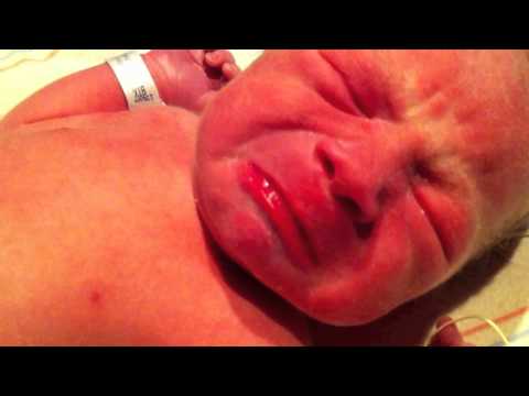 Poked and Prodded