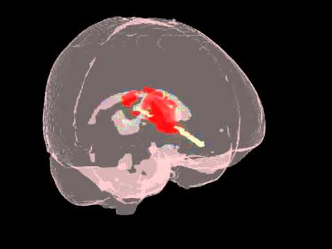 how to administer urokinase