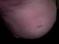 videos de los hermanos sin dolor