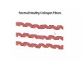 Video 2-Reverse/Prevent Heart Disease Naturallly-Pauling/Rath . Video 2-Reverse/Prevent Heart Disease Naturallly-Pauling/Rath .