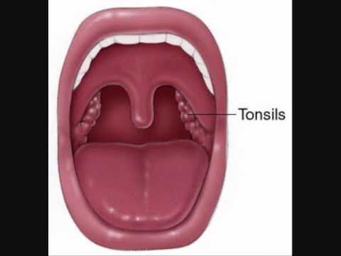 How to Identify and Treat Appendicitis Naturally (and avoid surgery)