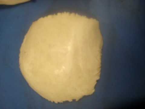 Parietal Bone