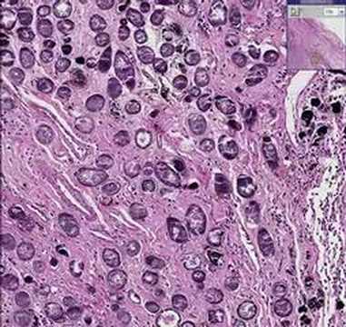 Histopathology Colon, rectum ...