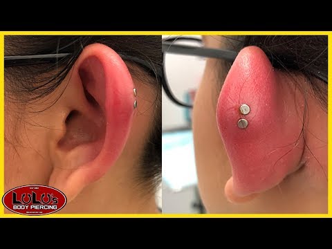 We Have Never Seen A Piercing This Swollen!!