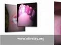 National Epidermolysis Bullosa Awareness Week