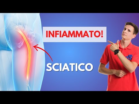 Nervo sciatico infiammato - 3 errori da evitare!