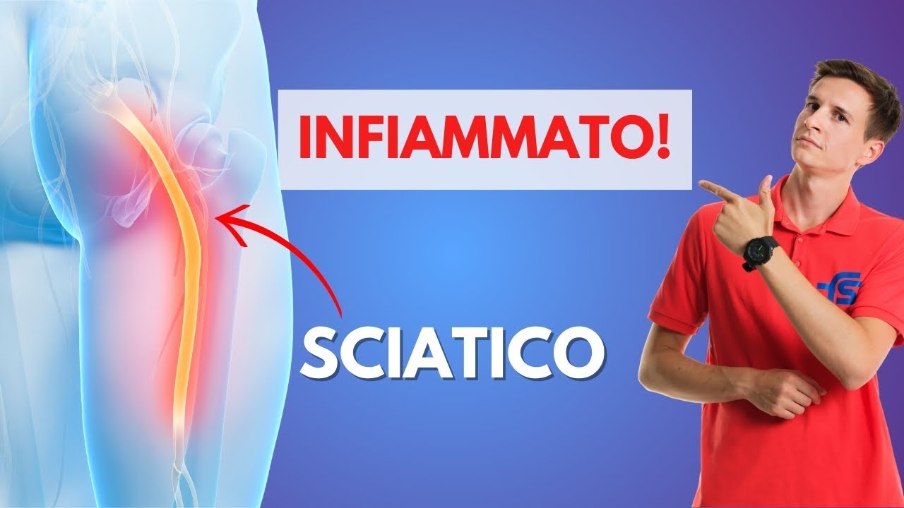 Nervo sciatico infiammato - 3 errori da evitare!