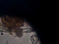 Tecameba Com Ciliados