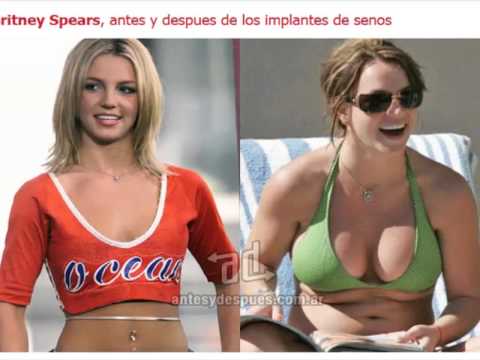 senos