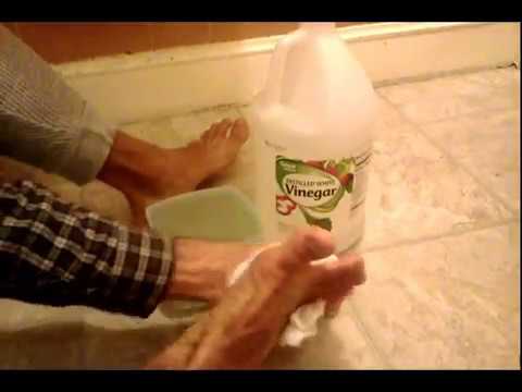 how to dissolve toenail fungus