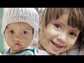 See Video