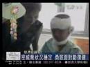 20080719 緬甸新哥鄔等待手術 看到慈濟志工比感恩