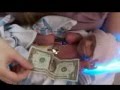 Preemie Ashlynn is 6 months old, her journey.