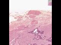 Shotgun Histology Prostate Shotgun Histology Prostate