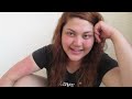 Click here to watch this video Ask Teena #2: SUNBURN + Bigger boobs?!