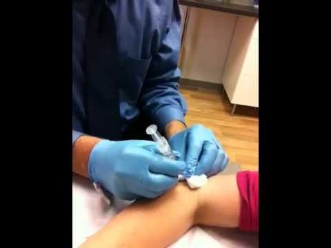 how to fit epicondylitis clasp