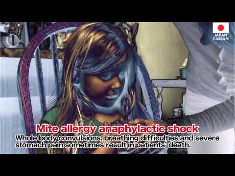 how to control dust mites