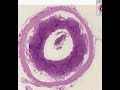 Shotgun Histology Appendix