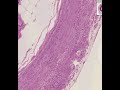 Shotgun Histology Appendix