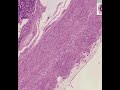 Shotgun Histology Appendix