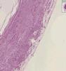 Shotgun Histology Appendix