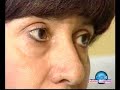 Tg3 Salute InForma - Ritalin Si, Ritalin No