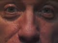 Thumbnail #3