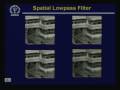 videos de Lecture - 20 Image Enhancement