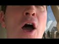 Thumbnail #1