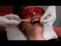 cosmetic dental procedures, teeth bonding, tooth bonding