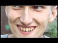 Frytka - Pojechał, Zobaczył