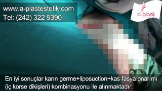 Gökhan Özerdem-57
