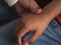 Tratamiento del Asma con Reflexologia Tratamiento del Asma con Reflexologia