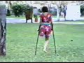 one legged barefoot girl one legged barefoot girl