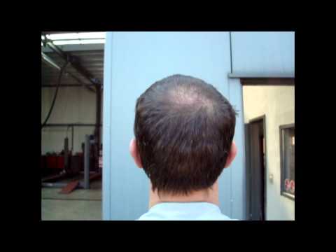 Bekijk video