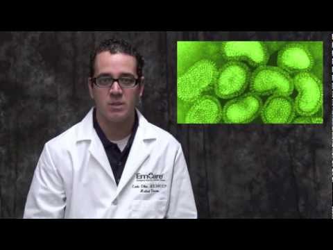 how to test for influenza a and b