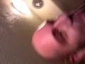 BIGGEST PIMPLE IN THE WORLD