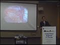 Interstitial Cystitis - The Smith Institute for Urology