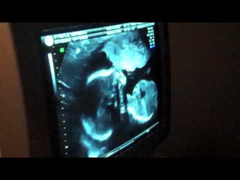 Ultrasound Anatomy Scan – 19 Weeks – MUSC Health