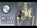 Que Es La Ciatica Y Como Se Produce