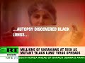 Plague or plan Ukraine's mystery disease 'burns out lungs'