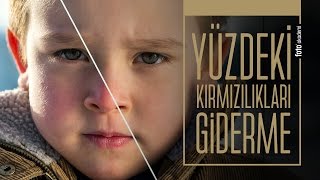 Photoshop' ta Yüz Kızarıklıklarını Gidermenin En Kolay Yolu (Kırmızı Yüz Renk Doğrulama)