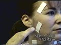 EMG Electrode Placement
