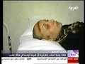 استشاري جراحة التجميل الدكتور ممدوح عشي يعالج الفنانة فوزان المصابة بالغرغرينا