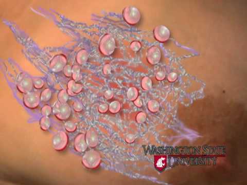 how to treat mastitis