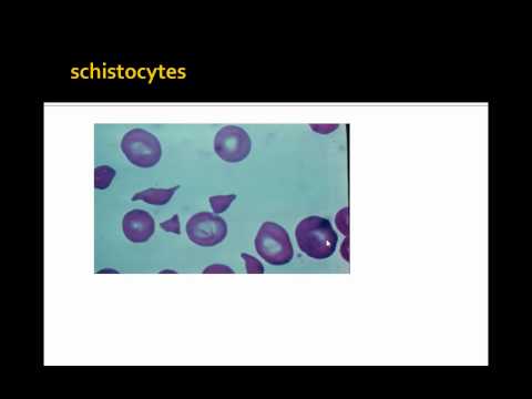 how to treat low rdw