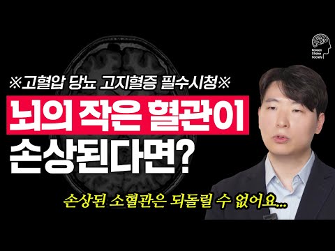 건강검진에서 발견된 '하얀 점'의 정체! 뇌졸중 전문의가 알려주는 소혈관 질환의 모든 것