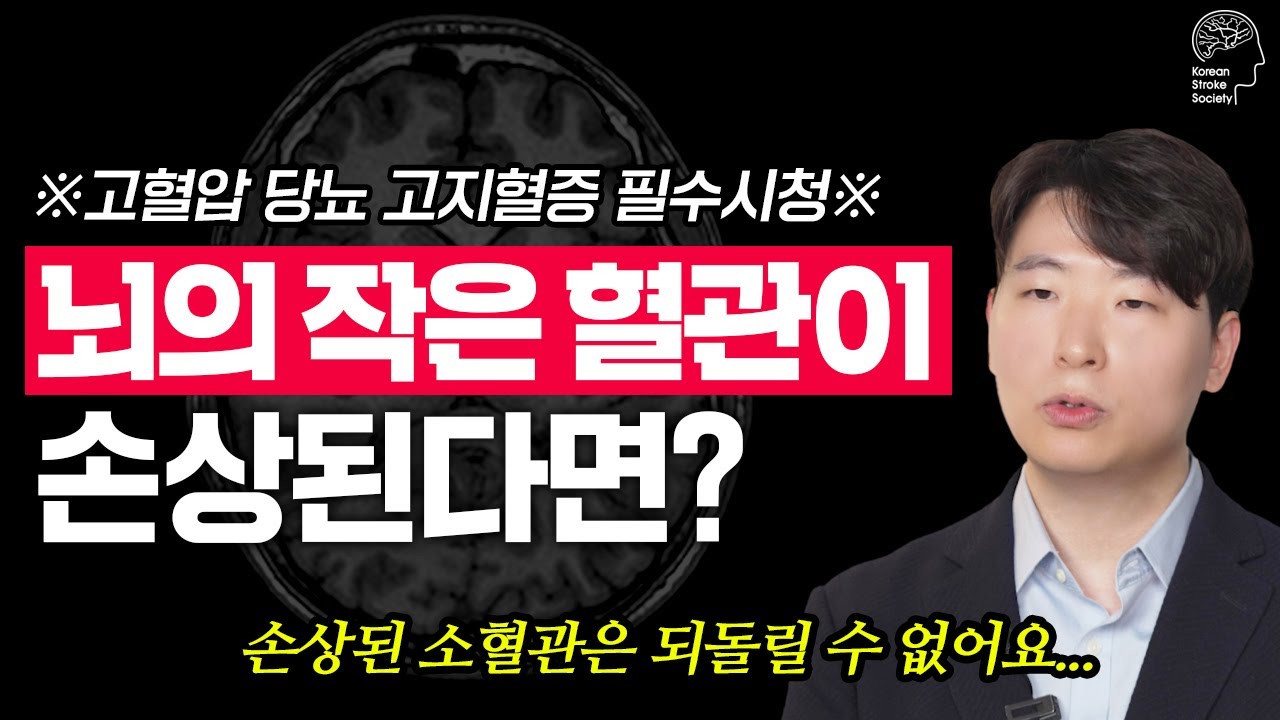 건강검진에서 발견된 '하얀 점'의 정체! 뇌졸중 전문의가 알려주는 소혈관 질환의 모든 것