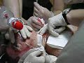 raw trach dv.wmv