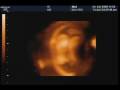 1� video do nosso baby